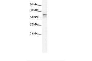 Image no. 2 for anti-One Cut Homeobox 2 (ONECUT2) (AA 293-342) antibody (ABIN202641)