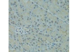 Immunohistochemistry (Paraffin-embedded Sections) (IHC (p)) image for anti-Influenza Virus NS1A Binding Protein (IVNS1ABP) antibody (ABIN7261056)
