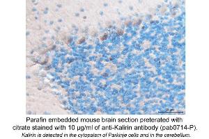 Image no. 1 for anti-Kalirin, RhoGEF Kinase (KALRN) (C-Term) antibody (ABIN559715)