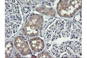 Image no. 3 for anti-HRas proto-oncogene, GTPase (HRAS) antibody (ABIN1498715)