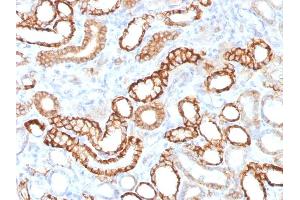 Image no. 3 for anti-Cadherin-16 (CDH16) antibody (ABIN6939024)