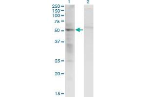 Image no. 2 for anti-Synovial Sarcoma Translocation, Chromosome 18 (SS18) (AA 116-216) antibody (ABIN520526)