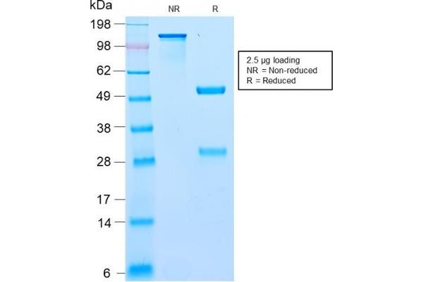anti-B-Cell CLL/lymphoma 10 (BCL10) (AA 122-168) antibody