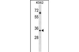 Image no. 1 for anti-Cell Cycle Checkpoint Protein RAD1 (RAD1) (AA 118-146) antibody (ABIN5532003)