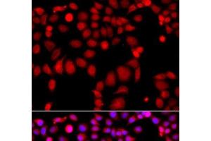 Immunofluorescence analysis of A549 cells using ARHGEF9 Polyclonal Antibody