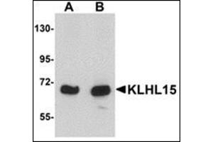 Image no. 2 for anti-Kelch-Like 15 (KLHL15) (C-Term) antibody (ABIN500128)
