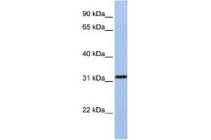 Image no. 2 for anti-Solute Carrier Family 25, Member 28 (SLC25A28) (C-Term) antibody (ABIN635044)