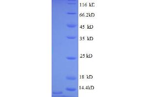 Image no. 1 for Chemokine (C-X-C Motif) Ligand 3 (CXCL3) (AA 35-107), (full length) protein (His tag) (ABIN1046734)