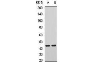 Image no. 2 for anti-Aryl Hydrocarbon Receptor Interacting Protein-Like 1 (AIPL1) (full length) antibody (ABIN6004332)