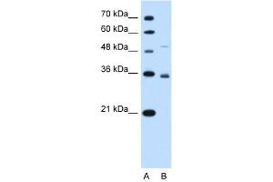 Image no. 2 for anti-Solute Carrier Family 38 Member 3 (SLC38A3) (N-Term) antibody (ABIN2775351)