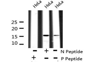 Image no. 4 for anti-Vesicle-Associated Membrane Protein 4 (VAMP4) (pSer30) antibody (ABIN6271356)