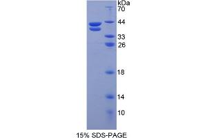 Image no. 1 for Resistin Like beta (RETNLB) (AA 24-111) protein (His tag,GST tag) (ABIN6236477)