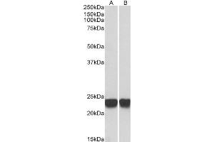 Image no. 3 for anti-Parkinson Protein 7 (PARK7) (C-Term) antibody (ABIN184951)