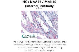 Image no. 1 for anti-MAK10 Homolog, Amino-Acid N-Acetyltransferase Subunit (MAK10) (Internal Region) antibody (ABIN1737187)