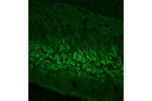 Image no. 2 for anti-Neurofilament, Light Polypeptide (NEFL) (AA 1-284) antibody (ABIN1742358)