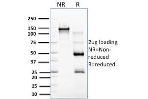 Image no. 1 for anti-Estrogen Receptor Binding Site Associated, Antigen, 9 (EBAG9) antibody (ABIN6941020)