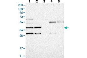 Image no. 1 for anti-Chromosome 6 Open Reading Frame 150 (C6orf150) antibody (ABIN5583231)