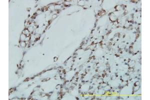 Image no. 1 for anti-Ribosomal Protein L39-Like (RPL39L) (AA 1-51) antibody (ABIN566752)