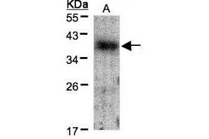 Image no. 2 for anti-V-Crk Sarcoma Virus CT10 Oncogene Homolog (Avian) (CRK) (AA 122-302) antibody (ABIN467422)