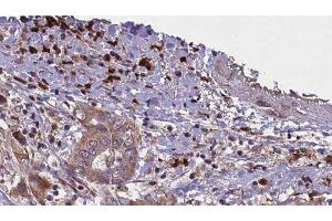 Image no. 4 for anti-Alkaline Phosphatase, Liver/bone/kidney (ALPL) antibody (ABIN6259900)