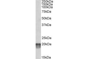 Image no. 2 for anti-NADH Dehydrogenase (Ubiquinone) Fe-S Protein 7, 20kDa (NADH-Coenzyme Q Reductase) (NDUFS7) (Internal Region) antibody (ABIN571200)