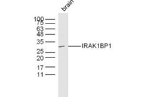 Image no. 1 for anti-Interleukin-1 Receptor-Associated Kinase 1 Binding Protein 1 (IRAK1BP1) (AA 51-150) antibody (ABIN2803281)