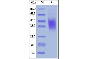 Image no. 2 for CD47 (CD47) (AA 19-140) (Active) protein (His tag) (ABIN6253634)