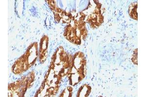 Image no. 2 for anti-Acid Phosphatase, Prostate (ACPP) antibody (ABIN6940391)