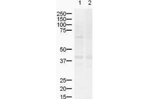 Western blot using  Affinity Purified anti-ZIC2 antibody shows detection of a band ~55 kDa (arrowhead) corresponding to ZIC2 in lysates from (lane 1) mouse brain and (lane 2) rat brain.
