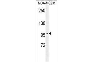 Image no. 1 for anti-Suppression of Tumorigenicity 7 (ST7) (AA 169-197) antibody (ABIN5532994)