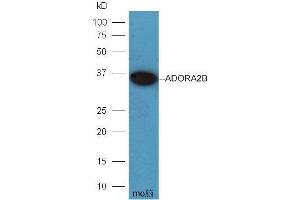 Image no. 3 for anti-Adenosine A2b Receptor (ADORA2B) (AA 145-178) antibody (ABIN759536)