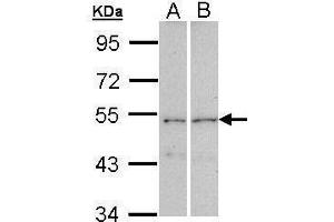 Image no. 1 for anti-Cytoplasmic Polyadenylation Element Binding Protein 1 (CPEB1) (C-Term) antibody (ABIN2855898)