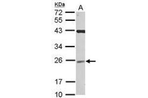 Image no. 1 for anti-Ubiquitin-Conjugating Enzyme E2F (UBE2F) (AA 1-185) antibody (ABIN1501629)