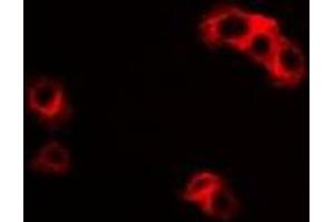 Image no. 1 for anti-Interleukin 23 Receptor (IL23R) antibody (ABIN3197697)