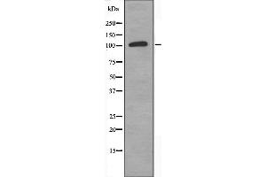 Image no. 1 for anti-Topoisomerase (DNA) III alpha (TOP3A) (C-Term) antibody (ABIN6259585)