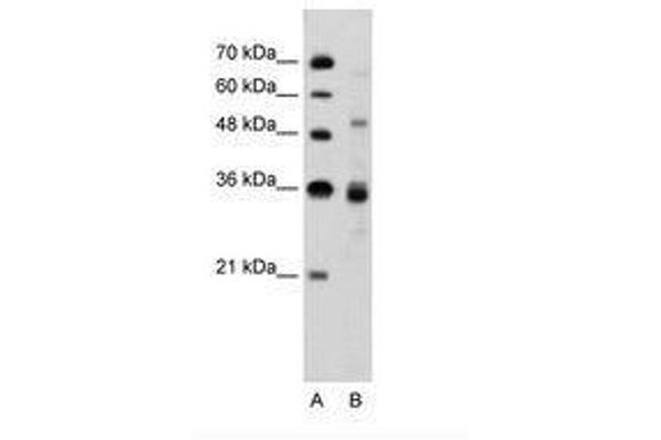 CELF3 anticorps  (N-Term)