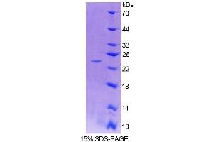 Image no. 1 for Chimerin (Chimaerin) 2 (CHN2) (AA 101-280) protein (His tag) (ABIN6239087)