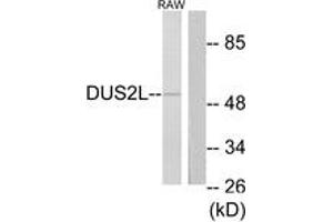 Image no. 1 for anti-Dihydrouridine Synthase 2-Like (DUS2L) (AA 421-470) antibody (ABIN1534152)