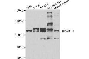 anti-Retinitis Pigmentosa GTPase Regulator Interacting Protein 1 (RPGRIP1) antibody