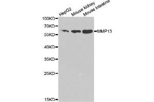 Image no. 1 for anti-Matrix Metallopeptidase 13 (Collagenase 3) (MMP13) antibody (ABIN3022225)