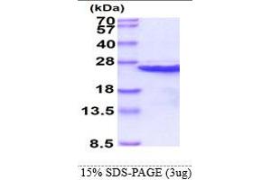 Image no. 1 for Calcium and Integrin-Binding Protein 1 (CIB1) (AA 1-191) protein (His tag) (ABIN666637)