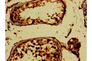 PKD2 anticorps  (AA 680-968)