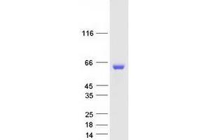 Image no. 1 for Protein Phosphatase, Mg2+/Mn2+ Dependent, 1B (PPM1B) (Transcript Variant 3) protein (Myc-DYKDDDDK Tag) (ABIN2729802)