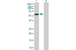 Image no. 1 for anti-Phosphatidylinositol 4-Kinase Type 2 alpha (PI4K2A) (AA 1-479) antibody (ABIN527524)