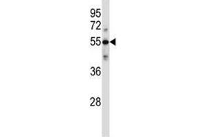 Image no. 2 for anti-Complement Component C9 (C9) (AA 191-220) antibody (ABIN3029695)
