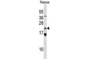 Image no. 1 for anti-COP9 Signalosome Subunit 8 (COPS8) (AA 1-30), (N-Term) antibody (ABIN951663)