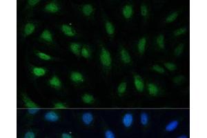 Immunofluorescence analysis of U2OS cells using GADD45A Polyclonal Antibody at dilution of 1:100.