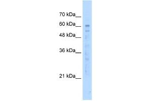 Image no. 1 for anti-EF-hand calcium binding domain 14 (EFCAB14) (N-Term) antibody (ABIN2782834)