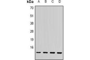Image no. 2 for anti-Sjogren Syndrome Nuclear Autoantigen 1 (SSNA1) antibody (ABIN2967064)