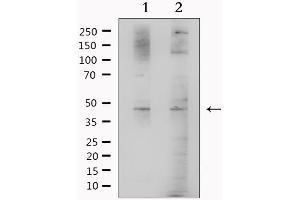 Image no. 1 for anti-Betaine--Homocysteine S-Methyltransferase (BHMT) (C-Term) antibody (ABIN6260258)